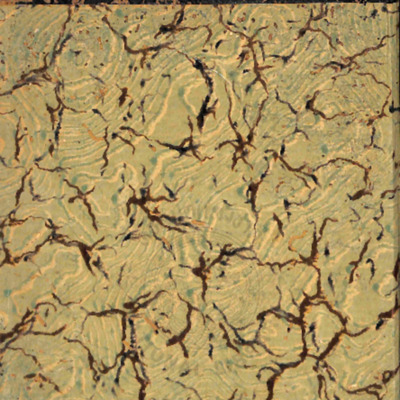 สงครามสืบราชสมบัติโปลันด์