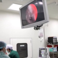 กระทรวงสาธารณสุขเพิ่มโรงพยาบาลผ่าตัดแบบวันเดียวกลับ